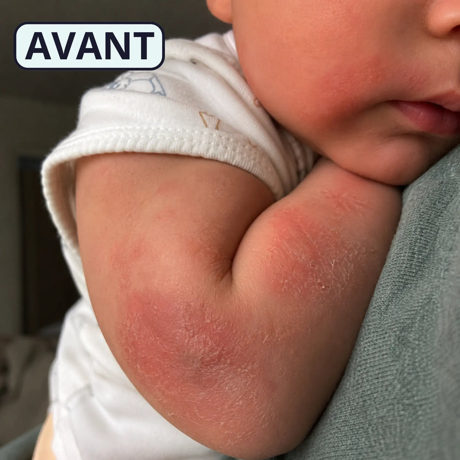 Avant